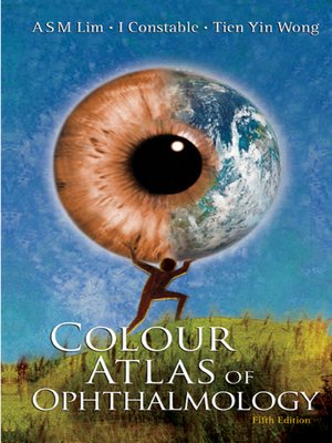 cover image of Colour Atlas of Ophthalmology ()
